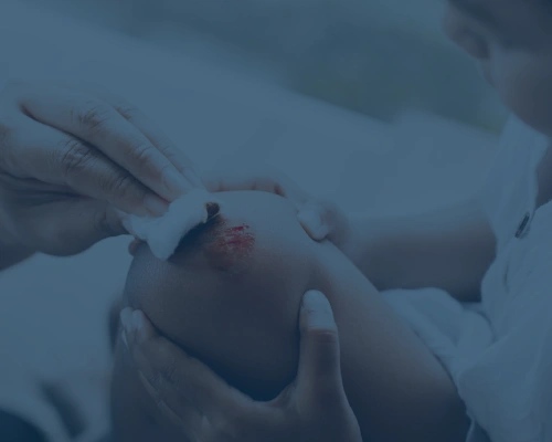 Wound Care Coding & Billing (1)